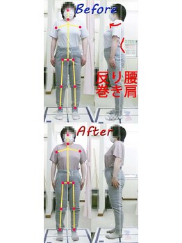 姫路なごみ整体院 なごみ鍼灸院/【改善例】腰痛・股関節・反り腰