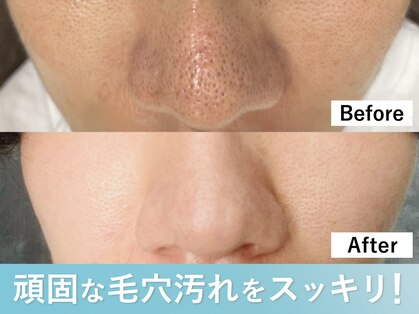 デジールの写真