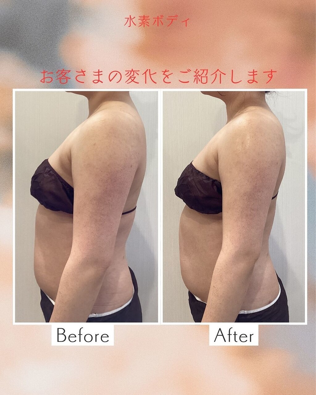 【6月限定】水素吸入＋エステで巻き肩卒業！姿勢良く華奢に♪ボディ22,000→