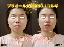 プリオール 太田店(Prior)の雰囲気（小顔モニター：30代/8回/コルギ+ヘッドマッサージ）