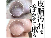 エメ(Aimer)の雰囲気（毛穴黒ずみ/皮脂つまり/開きなどのトラブル当店にお任せください）