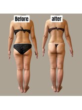 ベオ(Salon Beo)/下半身モニター様