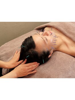 小顔になりたい