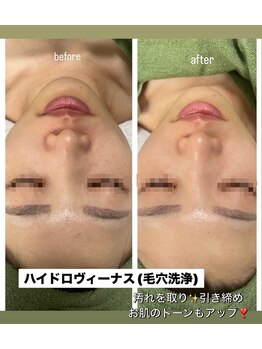 グレース バイ ジェリー(Grace×JERRY)/