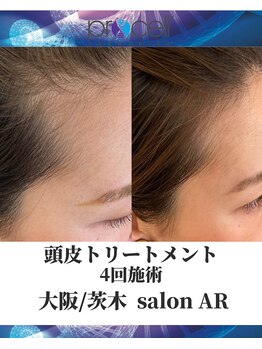 メンズサロンアール(AR)/プロセルセラピーズ
