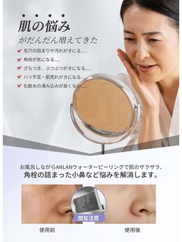 ピトレスク 大森山王(PITTORESQUE)の写真/《素肌美人を目指す!》毛穴レス★小鼻の黒ずみ!毛穴の開き&たるみ改善&ニキビケア◎シミ改善×代謝アップ♪