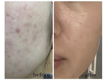 メルシー サロン(Merci Salon)の写真