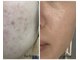 メルシー サロン(Merci Salon)の写真