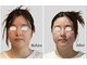 リフェイス(RE:FACE)の写真