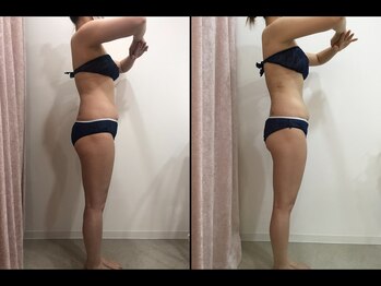 トータルビューティーサロン ナーズ(NAZ)/ハイパーナイフ&シェイプ