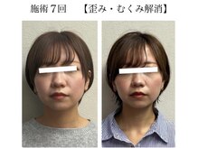 ラボーテヴェリテ(La Beaute Verite)/【お客様施術例】