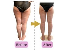 ケント整体院 ルース(KENT整体院 | Luz)/痩身エステ