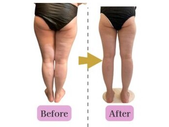 ケント整体院 ルース(KENT整体院 | Luz)/痩身エステ