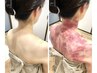 【首が動かない.ガチガチ肩こり】施術中から変化実感◎筋膜リリースかっさ