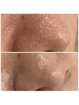 アネラ キキ サロン(anela kiki salon)/美肌肌質改善VOSサロンケア