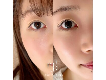 アモア(amoa)の写真