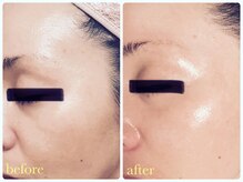 ベルドア(Bell Door)/【40代から始めるビタミンA】