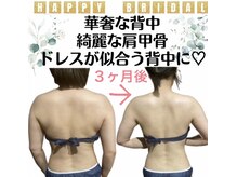 ビューティサロンツリー(TREE)の雰囲気（ブライダルを控えている方におすすめ♪お気軽にご相談を♪）