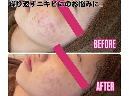 ミラリア(mirallia)の写真