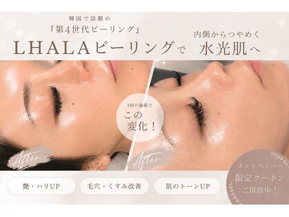 スールボーテ(soeur beaute)の写真