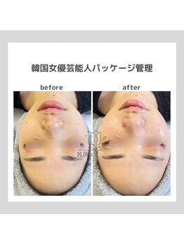 ポムハヌル(pom.haneul)/韓国肌管理室