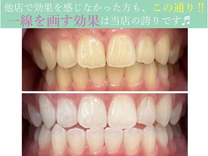 ホワイトニングショップ 御殿山店の写真