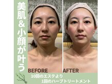 ラグーナ(Laguna)の雰囲気（美容成分導入型☆次世代ハーブトリートメントで本気の肌質改善！）