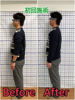 幸鍼灸整体院 武庫之荘院/整体・トレーニング・姿勢変化5