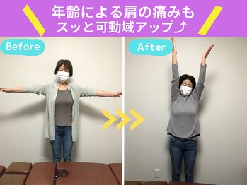 京都中丸整体カイロプラクティック/肩の痛み