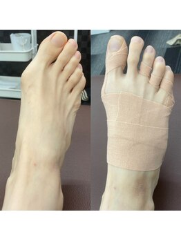 距骨サロン 岡山店)/親指の付け根の痛みが激減!