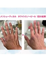 マリー エクラン/