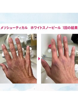 マリー エクラン/