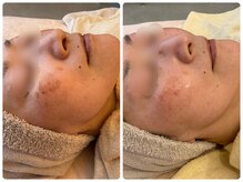 クラージュ/特殊シミケアもお任せ下さい！