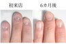 【2回目以降】 ★深爪ケアコース