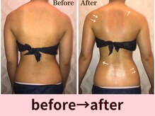 クイーンズチャーム(Queen's Charm)/パワーツリー背中の変化★