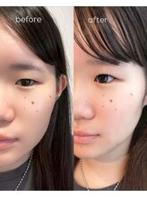 グロウ(Grow)/まつ毛パーマ【まつ毛/眉毛】