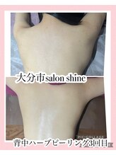 サロンシャイン(Salon Shine)/背中ハード