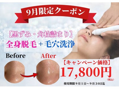 シエルエトワール(Ciel Etoile)の写真