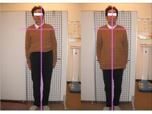 ゆるみ整体院/整体ビフォーアフター　２