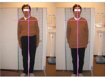 ゆるみ整体院/整体ビフォーアフター 2