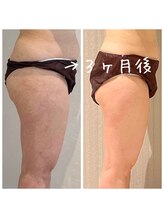 デジール(DESIR)/冷え性改善★血行促進