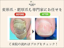 巻き爪補正店 横浜関内店の雰囲気（変形爪もお任せください♪ご来院の流れはブログをチェック！）
