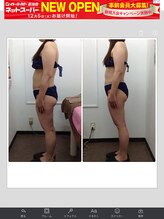 健康痩身研究所 名和店/ビフォーアフター