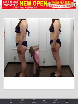 健康痩身研究所 名和店/ビフォーアフター