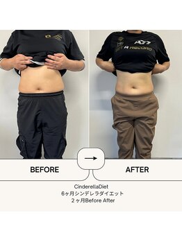 オーシャン整骨院(OCEAN整骨院)/６ヶ月コース