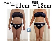 アナパ・オラ/全身痩せコース♪