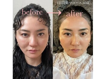 エヌ アンド エイチ ソニックフィット(N&H sonicfit)/ホームケア化粧品販売