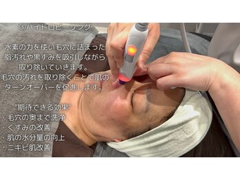 ミトノウ(MITONOU)/エアセラム ハイドロピーリング