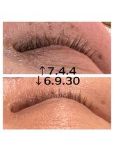 ビューティールーム 優美/まつ毛美容液の効果