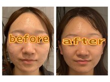 ドクタースタイル(Dr.style)の雰囲気（話題沸騰中の美容マシン痩身＆小顔速攻☆小顔マッサージ）